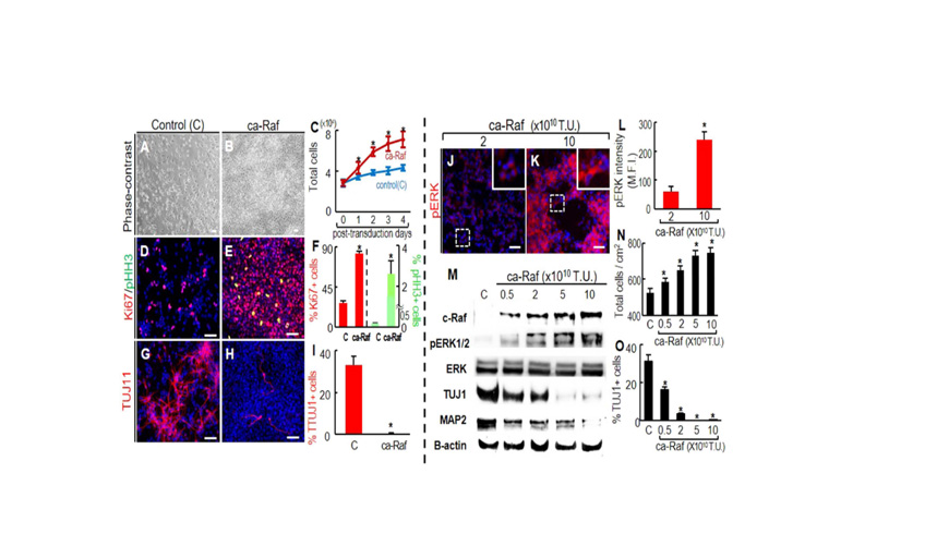 Nature| 神经干细胞分泌因子促进脑组织再生机理